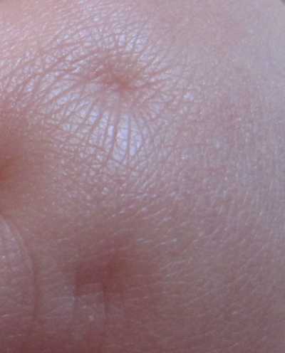 Baby skin